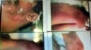 Amnesty International Says EU States Exporting Torture Instruments 