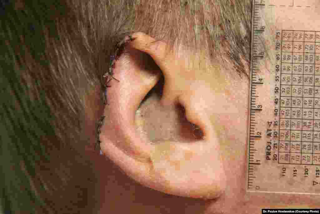 Part of Dmytro Bulatov's ear was cut off during his abduction.