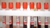 Russian Vaccine Developer Further Tempers Official's Claim Of October Rollout
