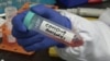 Can Plasma Transfusions Give COVID-19 Patients A Fast Track To Immunity?
