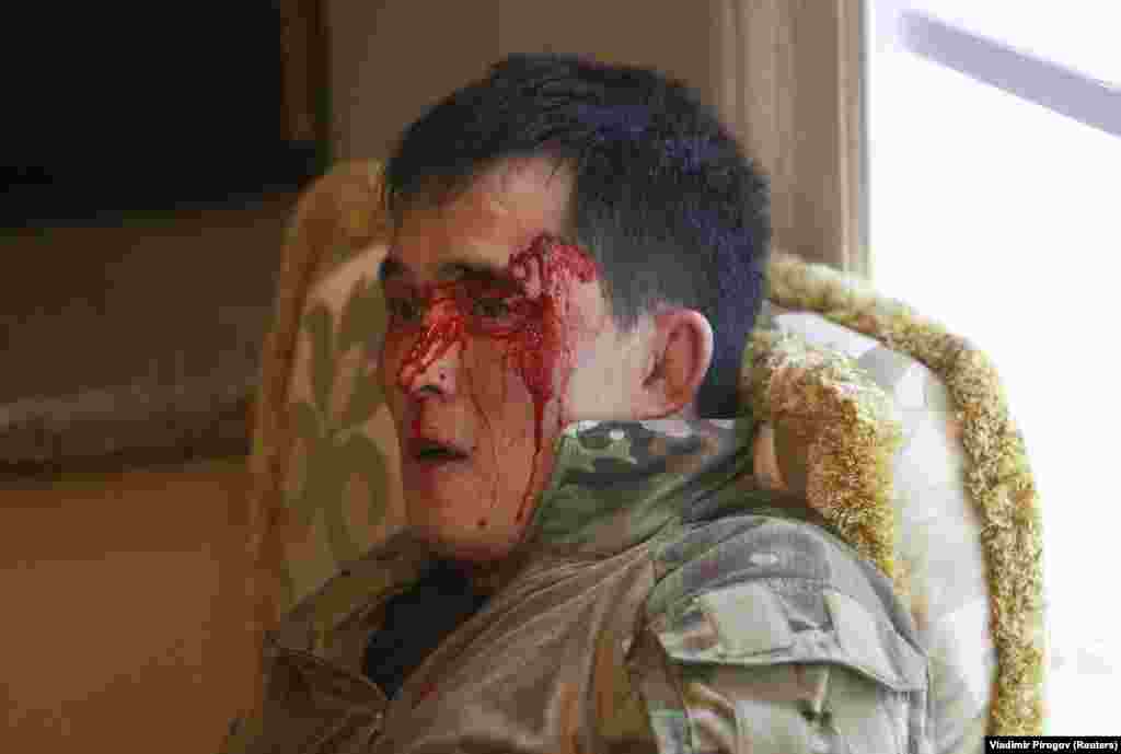 A bloodied member of the Kyrgyz special forces who was injured in the storming of the compound 