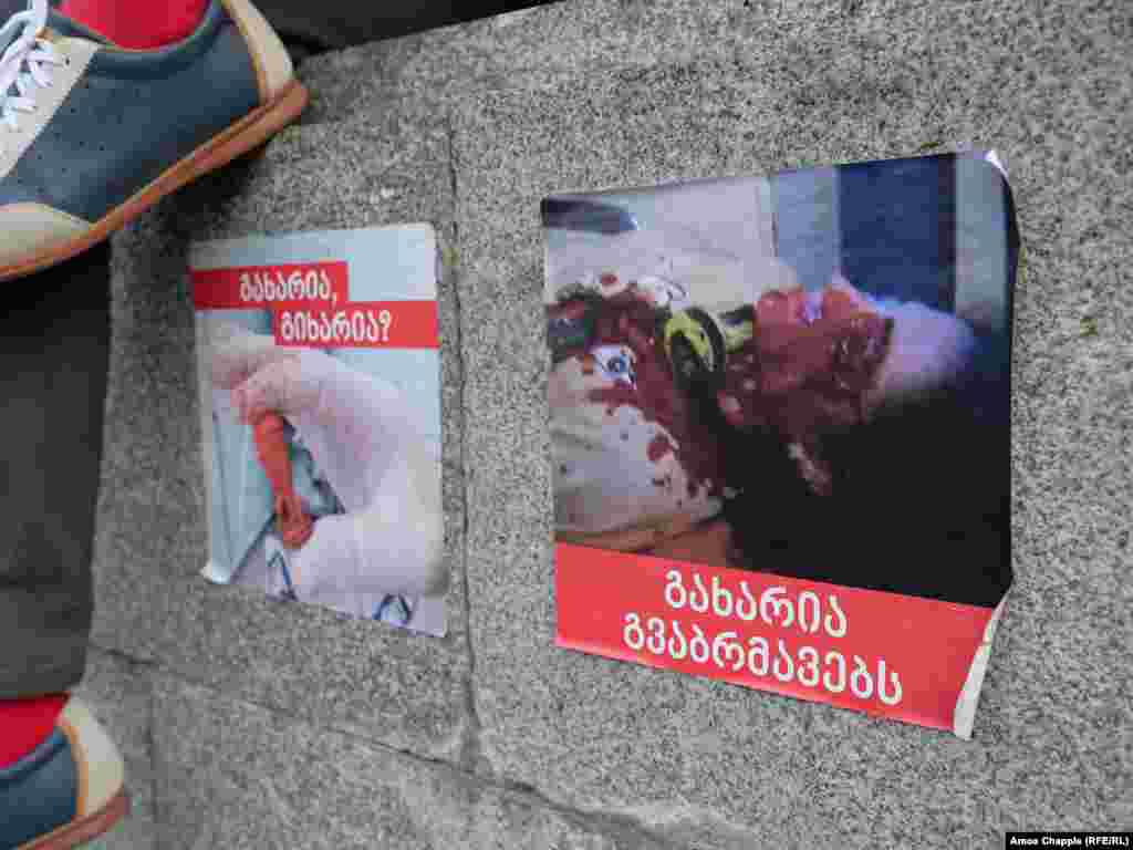 Posters in front of the parliament building in Tbilisi. Protesters say the image on the right shows a demonstrator who was struck in the eye with a rubber bullet on the evening of June 20.