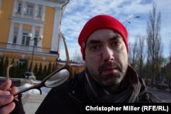 Canadian journalist Michael Colborne was punched in the face by a counterdemonstrators at a Transgender rights rally in Kyiv on November 18. He suffered a swollen lip and cuts on his face from his broken glasses.