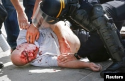 An injured man is attended to by police in Marseille after the match between Russia and England.