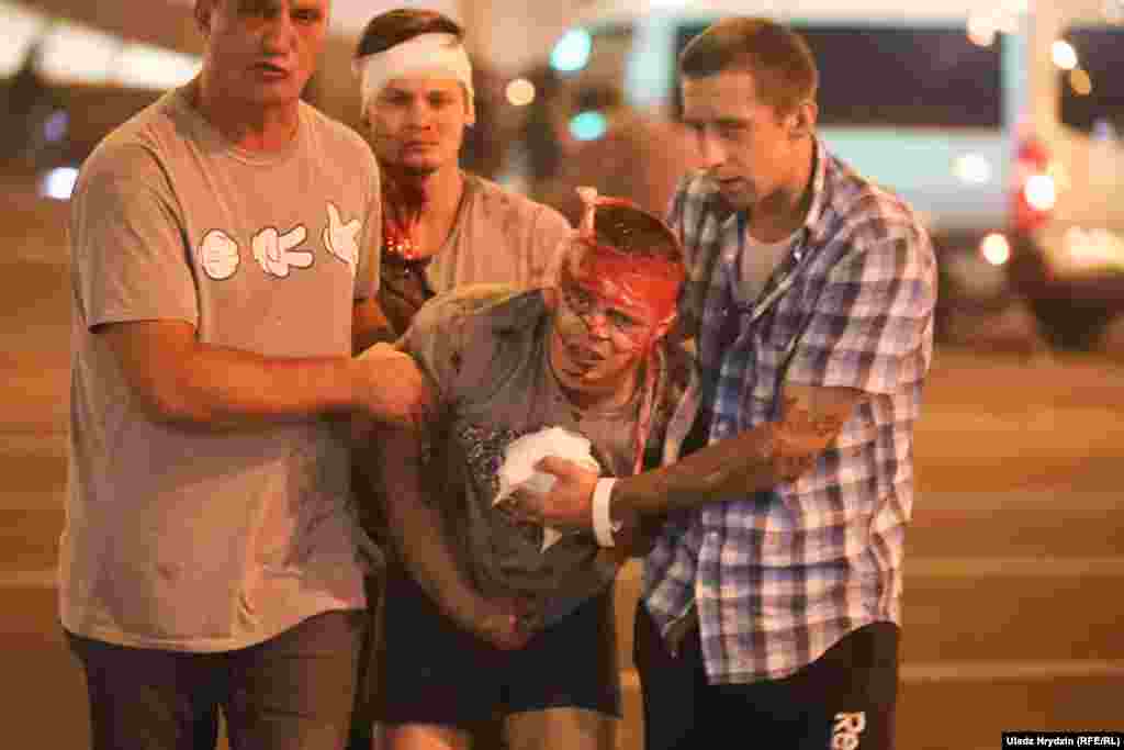An injured man is given assistance in Minsk. Police have fired rubber bullets, flash-bang grenades, and tear-gas canisters at protesters who accuse President Alyaksandr Lukashenka of falsifying the results of the country's election on August 9.